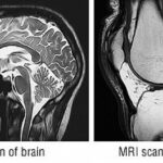 顎 関節 症 病院 何 科
